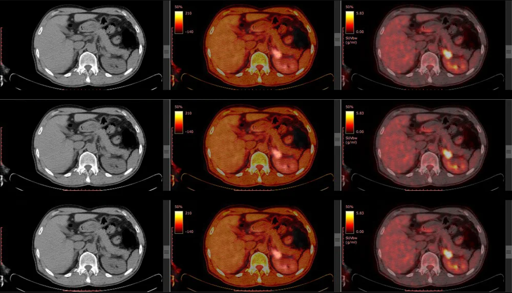 Screenshot 2025 01 09 203133 - PET Scan Lucknow