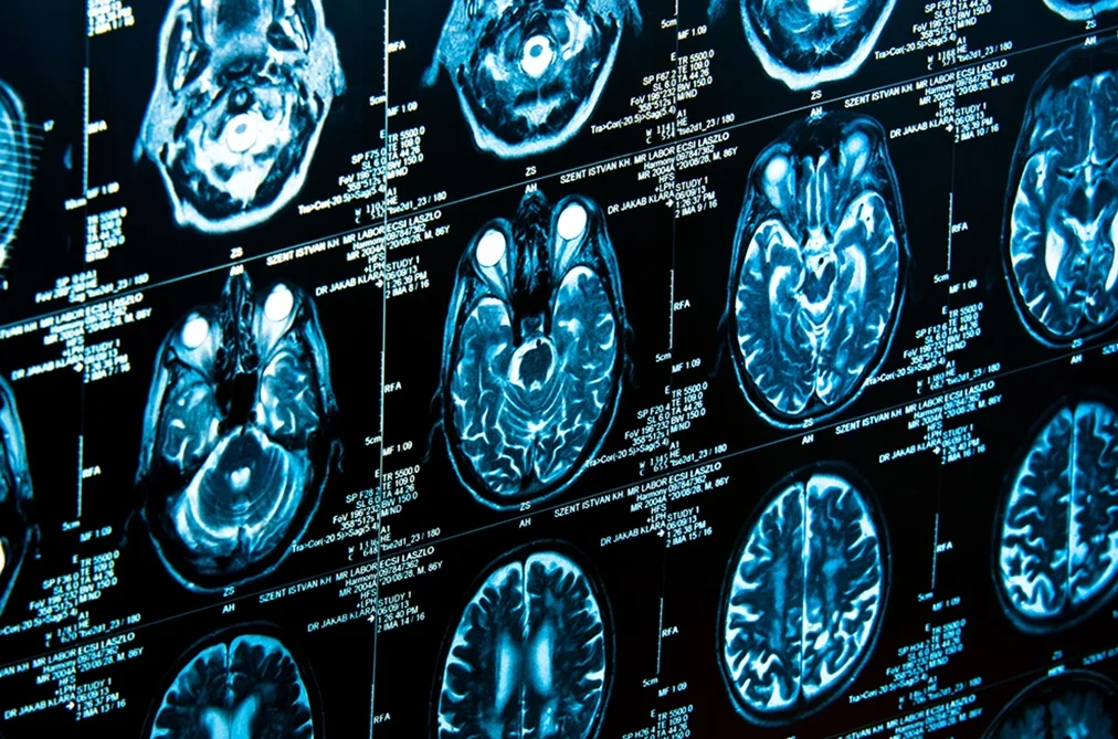 Screenshot 2025 02 18 222241 - PET Scan Lucknow