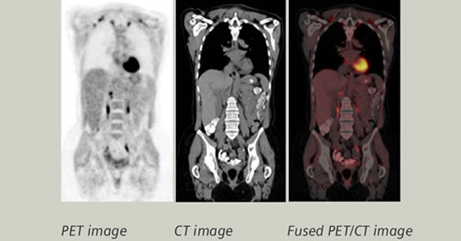 How long does a PET scan take?