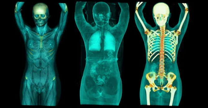 Pet5 - PET Scan Lucknow