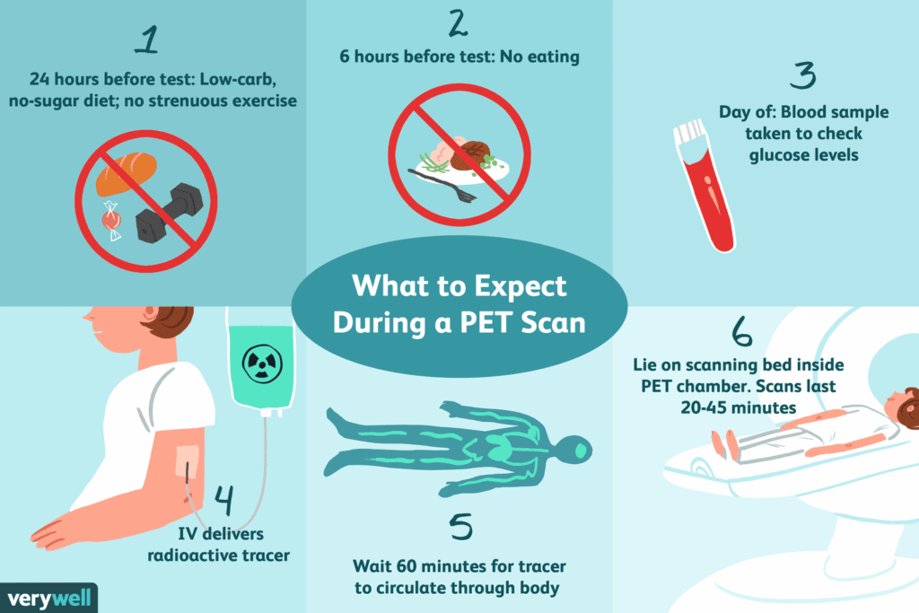 pet scan do and donts