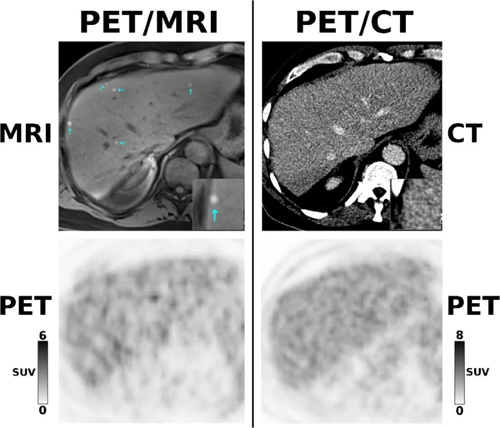 259 2019 4452 Fig2 Html 1024X878 - PET Scan Lucknow