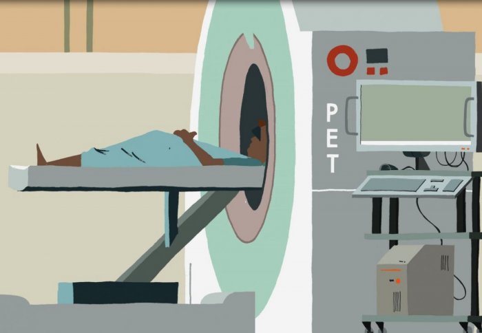pet scan patient
