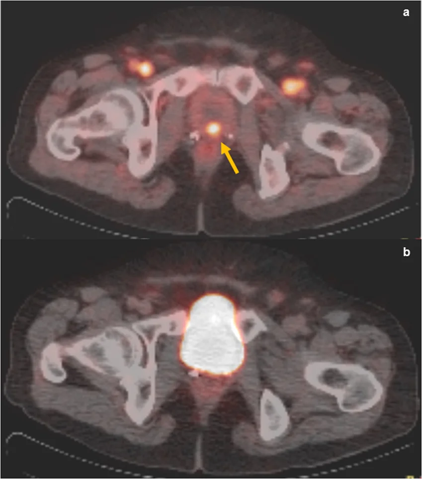 41598 2020 59296 Fig1 Html - PET Scan Lucknow
