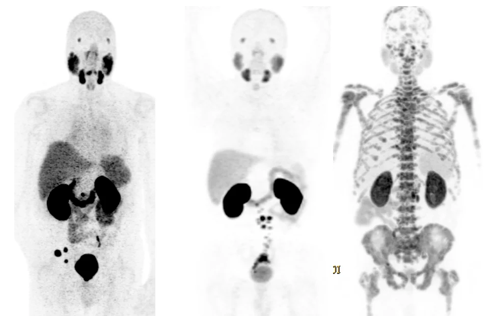 Screen Shot 2022 04 06 At 1 - PET Scan Lucknow