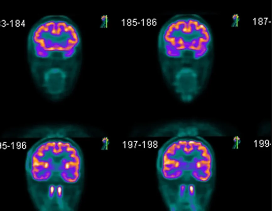 Screenshot 2025 05 26 221605 - PET Scan Lucknow