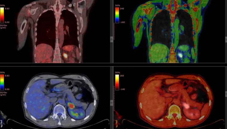 Screenshot 2025 05 31 200321 - PET Scan Lucknow