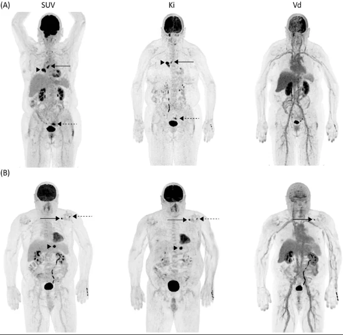 Screenshot 2025 05 31 200430 - PET Scan Lucknow