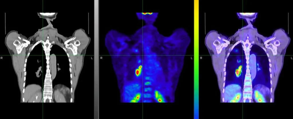 Secondary Images 1024X417 - PET Scan Lucknow