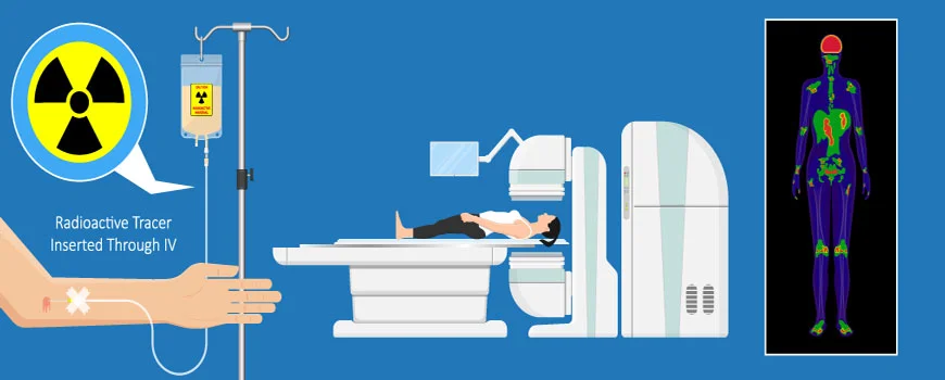 What Is A Pet Ct Scan - PET Scan Lucknow