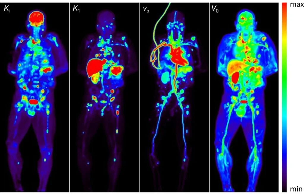 Cost Of Whole Body PET Scan