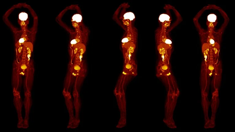 D41586 019 01833 Z 16790248 - PET Scan Lucknow